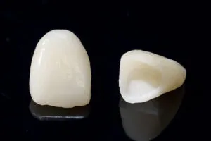 セラミック治療